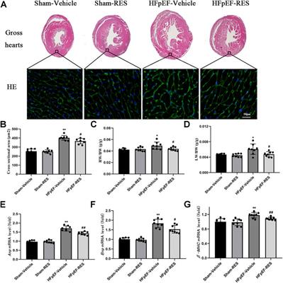 Resveratrol Ameliorates Cardiac Remodeling in a Murine Model of Heart Failure With Preserved Ejection Fraction